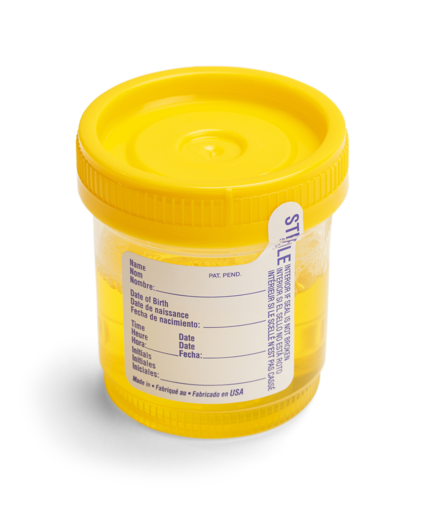 What Is The Irony Of Urine Testing In Ohio DUI/OVI Cases? — Columbus