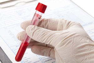 http://www.dreamstime.com/royalty-free-stock-photo-blood-test-hand-latex-glove-holding-sample-vial-front-form-image37079485